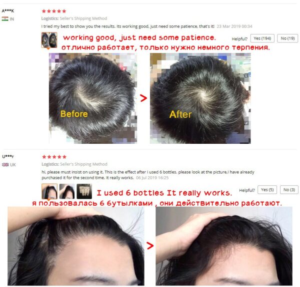 OMY LADY Hair Care Hair Growth Essential Oil Essence Original Authentic 100% Hair Loss Liquid BODY Care Beauty Dense Hair Growth